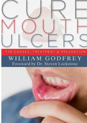 Cure Mouth Ulcers