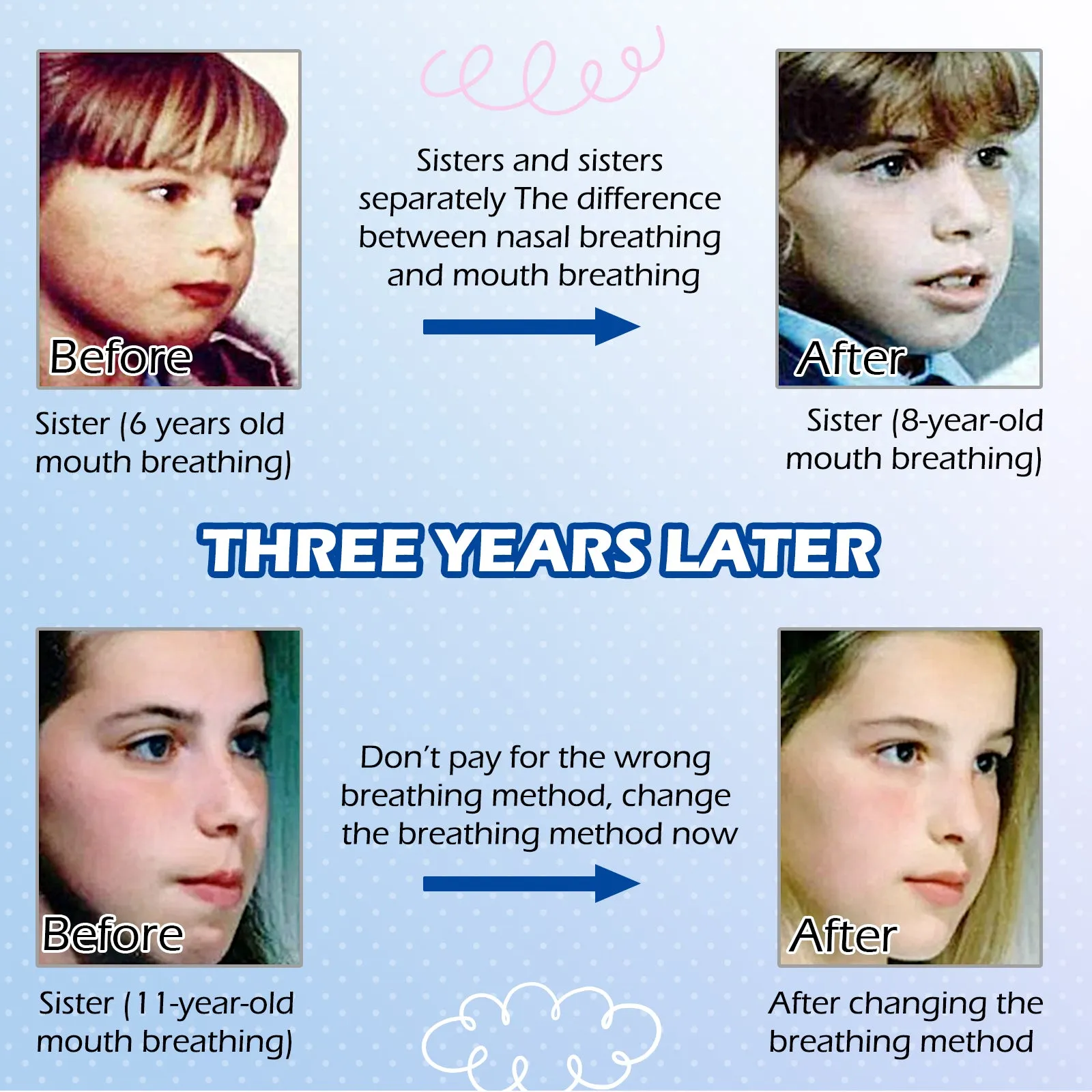 Elaimei Kids Sleep Strips, Nasal Breathing Support